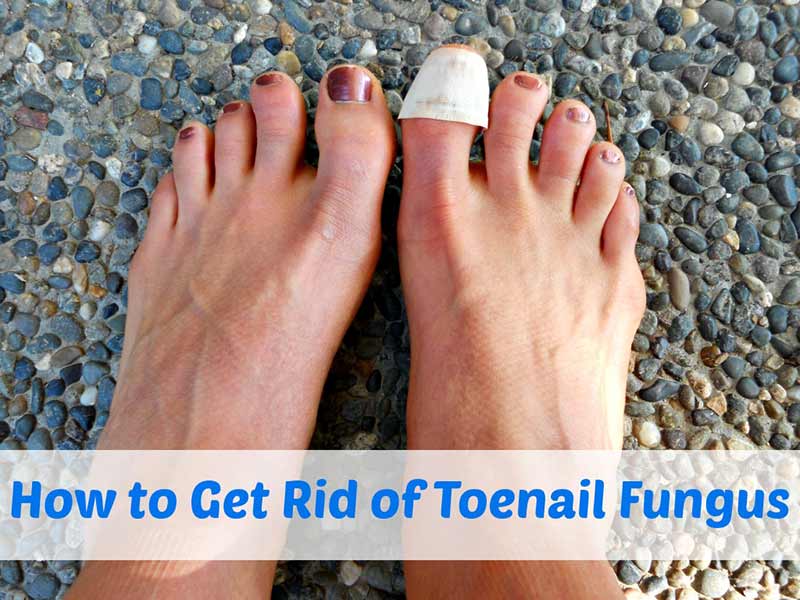 fungus under the toenail how to get rid of it