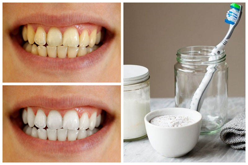 teeth whitening homemade paste works really ingredients sulfate sodium lauryl sles sls laureth