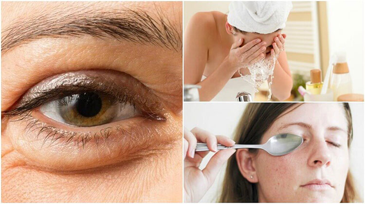 Natural Ways To Reduce Eye Bags Natural Ways To Reduce Eye Bags