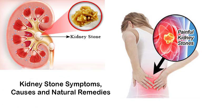 does sulfasalazine hurt your kidneys